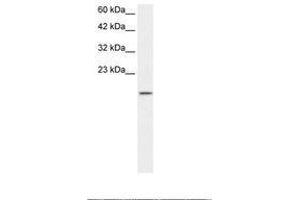 Image no. 1 for anti-Zinc Finger Protein 7 (ZNF7) (AA 62-111) antibody (ABIN202870) (ZNF7 Antikörper  (AA 62-111))