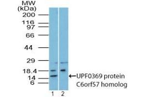 Image no. 1 for anti-Chromosome 6 Open Reading Frame 57 (C6ORF57) (AA 75-104) antibody (ABIN960066) (C6ORF57 Antikörper  (AA 75-104))