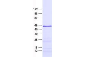 Western Blotting (WB) image for FEZ Family Zinc Finger 2 (FEZF2) protein (His tag) (ABIN2721026)