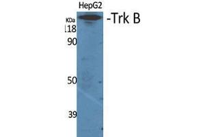 Western Blot (WB) analysis of specific cells using Trk B Polyclonal Antibody. (TRKB Antikörper  (Thr184))