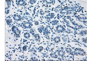 Immunohistochemical staining of paraffin-embedded breast tissue using anti-FH mouse monoclonal antibody. (FH Antikörper)