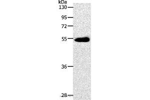 Western blot analysis of Human colon cancer tissue, using SLC2A3 Polyclonal Antibody at dilution of 1:400 (SLC2A3 Antikörper)