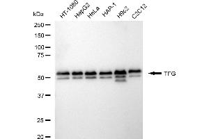 Western blotting analysis using TFG antibody (ABIN7800647). (Rekombinanter TFG Antikörper)