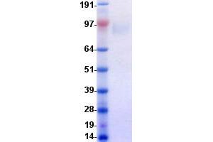 Validation with Western Blot