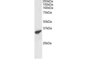 Image no. 1 for anti-Polycomb Group Ring Finger 3 (PCGF3) (C-Term) antibody (ABIN374301) (PCGF3 Antikörper  (C-Term))