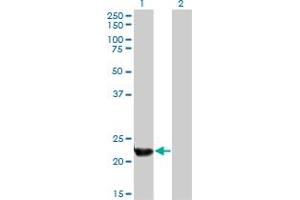 Western Blot analysis of PLDN expression in transfected 293T cell line by PLDN monoclonal antibody (M01), clone 2H8.