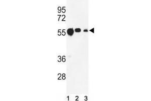 Western blot analysis of anti-beta Tubulin antibody and (1) CEM, (2) MCF-7, and (3) MDA-MB231 lysate. (TUBB1 Antikörper)