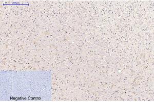 Immunohistochemical analysis of paraffin-embedded mouse brain tissue. (Caspase 8 Antikörper)