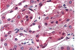 Kidney: Formalin-Fixed, Paraffin-Embedded (FFPE) (SCNN1G Antikörper  (C-Term))