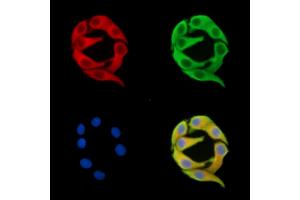 ABIN7096163 and ABIN7100225 staining Hela cells by IF/ICC. (AIDA Antikörper)
