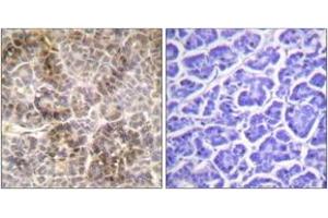 Immunohistochemistry analysis of paraffin-embedded human pancreas, using Moesin/Ezrin/Radixin (Phospho-Thr558) Antibody. (Moesin/ezrin/radixin (AA 524-573), (pThr558) Antikörper)