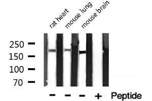 Western Blotting (WB) image for anti-Integrin beta 4 (ITGB4) (C-Term) antibody (ABIN6262617)