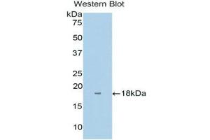 Western Blotting (WB) image for anti-Interleukin 1 Receptor Accessory Protein (IL1RAP) (AA 420-558) antibody (ABIN3202838) (IL1RAP Antikörper  (AA 420-558))
