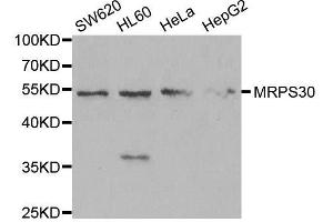 Western blot analysis of extracts of various cell lines, using MRPS30 antibody. (MRPS30 Antikörper  (AA 190-439))
