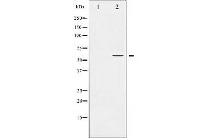 Western blot analysis of PPAR-gamma expression in HuvEc whole cell lysates,The lane on the left is treated with the antigen-specific peptide. (PPARG Antikörper  (Internal Region))