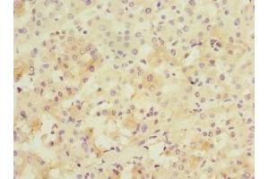Immunohistochemistry (IHC) image for anti-Protein Phosphatase, Mg2+/Mn2+ Dependent, 1D (PPM1D) (AA 1-250) antibody (ABIN7165942)