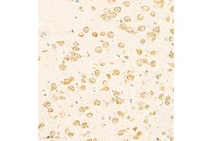 Immunohistochemistry of paraffin embedded mouse brain using SCN4b (ABIN7075646) at dilution of 1:2000 (300x lens)