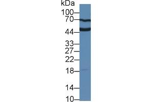 Detection of UPK3A in Human Serum using Polyclonal Antibody to Uroplakin 3A (UPK3A) (Uroplakin 3A Antikörper  (AA 15-211))