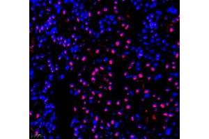 Immunofluorescence of paraffin embedded mouse kidney using PABPN1 (ABIN7075116) at dilution of 1:600 (400x lens) (PABPN1 Antikörper)