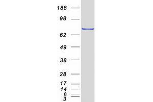 Western Blotting (WB) image for Transcription Factor 25 (Basic Helix-Loop-Helix) (TCF25) protein (Myc-DYKDDDDK Tag) (ABIN2733356)