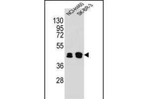 KRT80 Antibody (C-term) (ABIN654828 and ABIN2844502) western blot analysis in NCI-,SK-BR-3 cell line lysates (35 μg/lane). (KRT80 Antikörper  (C-Term))