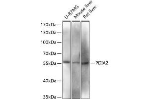 Western blot analysis of extracts of various cell lines, using PDI antibody (ABIN6128422, ABIN6145387, ABIN6145388 and ABIN6216541) at 1:3000 dilution. (PDIA2 Antikörper  (AA 326-525))