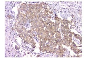 IHC analysis of WWOX using anti-WWOX antibody (ABIN6719627). (WWOX Antikörper  (AA 1-245))