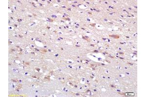 Formalin-fixed and paraffin embedded rat brain labeled with Anti-HIP2 Polyclonal Antibody, Unconjugated (ABIN1387369) at 1:200 followed by conjugation to the secondary antibody and DAB staining. (UBE2K Antikörper  (AA 51-150))