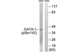 Western blot analysis of extracts from K562 cells, using GATA1 (Phospho-Ser142) Antibody.