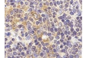 Immunohistochemistry of TLR9 in mouse spleen cells with this product at 2 μg/ml. (TLR9 Antikörper  (C-Term))