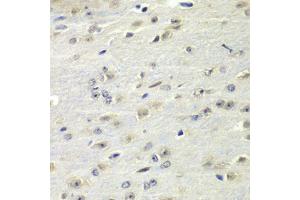 Immunohistochemistry (IHC) image for anti-Fragile X Mental Retardation 1 (FMR1) (AA 1-290) antibody (ABIN6140718)