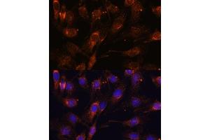 Immunofluorescence analysis of C6 cells using SC antibody (ABIN7270188) at dilution of 1:100. (SCAMP2 Antikörper  (AA 1-152))