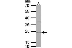 WB Image CD74 antibody [N1N2], N-term detects CD74 protein by Western blot analysis.