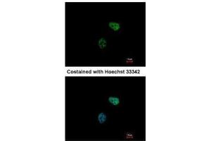 ICC/IF Image Immunofluorescence analysis of paraformaldehyde-fixed HeLa, using PSMC6, antibody at 1:500 dilution. (PSMC6 Antikörper)