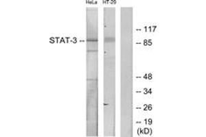 Western blot analysis of extracts from HeLa/HT-29 cells, using STAT3 (Ab-727) Antibody. (STAT3 Antikörper  (AA 694-743))