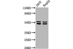 Western Blot Positive WB detected in: 293T whole cell lysate, HepG2 whole cell lysate All lanes: TRNT1 antibody at 5 μg/mL Secondary Goat polyclonal to rabbit IgG at 1/50000 dilution Predicted band size: 51, 48, 7 kDa Observed band size: 51, 48 kDa (Trnt1 Antikörper  (AA 128-293))