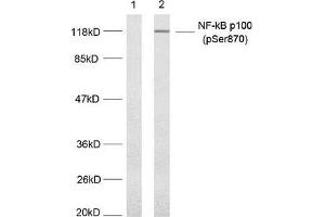 Western blot analysis of extract from MDA-MB-435 cells untreated or treated with TNF-alpha, (20 ng/mL, 5 min) using NF-κ,B p100(phospho-Ser870) antibody. (NFKB2 Antikörper  (pSer870))