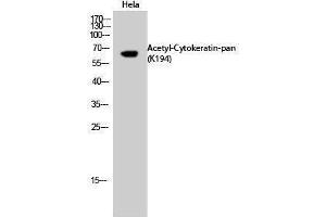 Western Blotting (WB) image for anti-Keratin 1 (KRT1) (acLys194) antibody (ABIN3181898) (Cytokeratin 1 Antikörper  (acLys194))