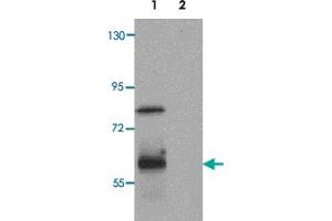 Western blot analysis of RASSF10 in human lung tissue lysate with RASSF10 polyclonal antibody  at 1 ug/mL. (RASSF10 Antikörper  (N-Term))