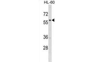 Western Blotting (WB) image for anti-Transcription Factor AP-2 delta (Activating Enhancer Binding Protein 2 Delta) (TFAP2D) antibody (ABIN2999809) (TFAP2D Antikörper)