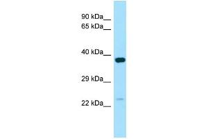 WB Suggested Anti-NXNL1 Antibody Titration: 1. (NXNL1 Antikörper  (C-Term))