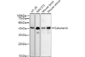 Western blot analysis of extracts of various cell lines, using (ABIN7266050) at 1:500 dilution. (CALU Antikörper)