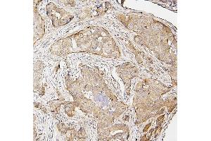 IHC analysis of IRF3 using anti-IRF3 antibody (ABIN7601885).