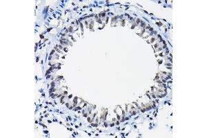 Immunohistochemistry of paraffin-embedded rat lung using SSN Rabbit pAb (3377) at dilution of 1:100 (40x lens). (SSNA1 Antikörper  (AA 1-119))