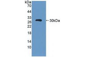 Detection of Recombinant ABCC3, Human using Polyclonal Antibody to ATP Binding Cassette Transporter C3 (ABCC3) (ABCC3 Antikörper  (AA 1291-1523))