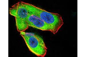 Immunofluorescence (IF) image for anti-Uncoupling Protein 2 (Mitochondrial, Proton Carrier) (UCP2) (AA 1-309) antibody (ABIN5542465)
