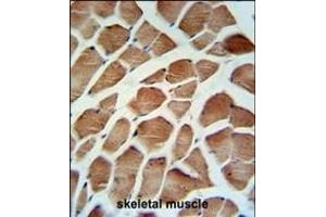 CA5B Antibody (C-term) (ABIN652315 and ABIN2841444) IHC analysis in formalin fixed and paraffin embedded human skeletal muscle followed by peroxidase conjugation of the secondary antibody and DAB staining. (CA5B Antikörper  (C-Term))