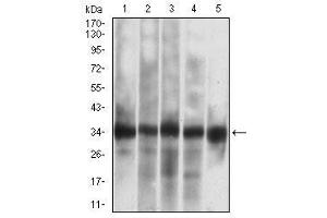 Western Blotting (WB) image for anti-Caspase 7, Apoptosis-Related Cysteine Peptidase (CASP7) (AA 29-198) antibody (ABIN5542605)