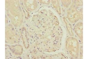 Immunohistochemistry of paraffin-embedded human kidney tissue using ABIN7148059 at dilution of 1:100 (CCHCR1 Antikörper  (AA 483-782))