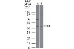 Image no. 1 for anti-Chemokine (C-C Motif) Receptor 4 (CCR4) (AA 337-351) antibody (ABIN1100490) (CCR4 Antikörper  (AA 337-351))